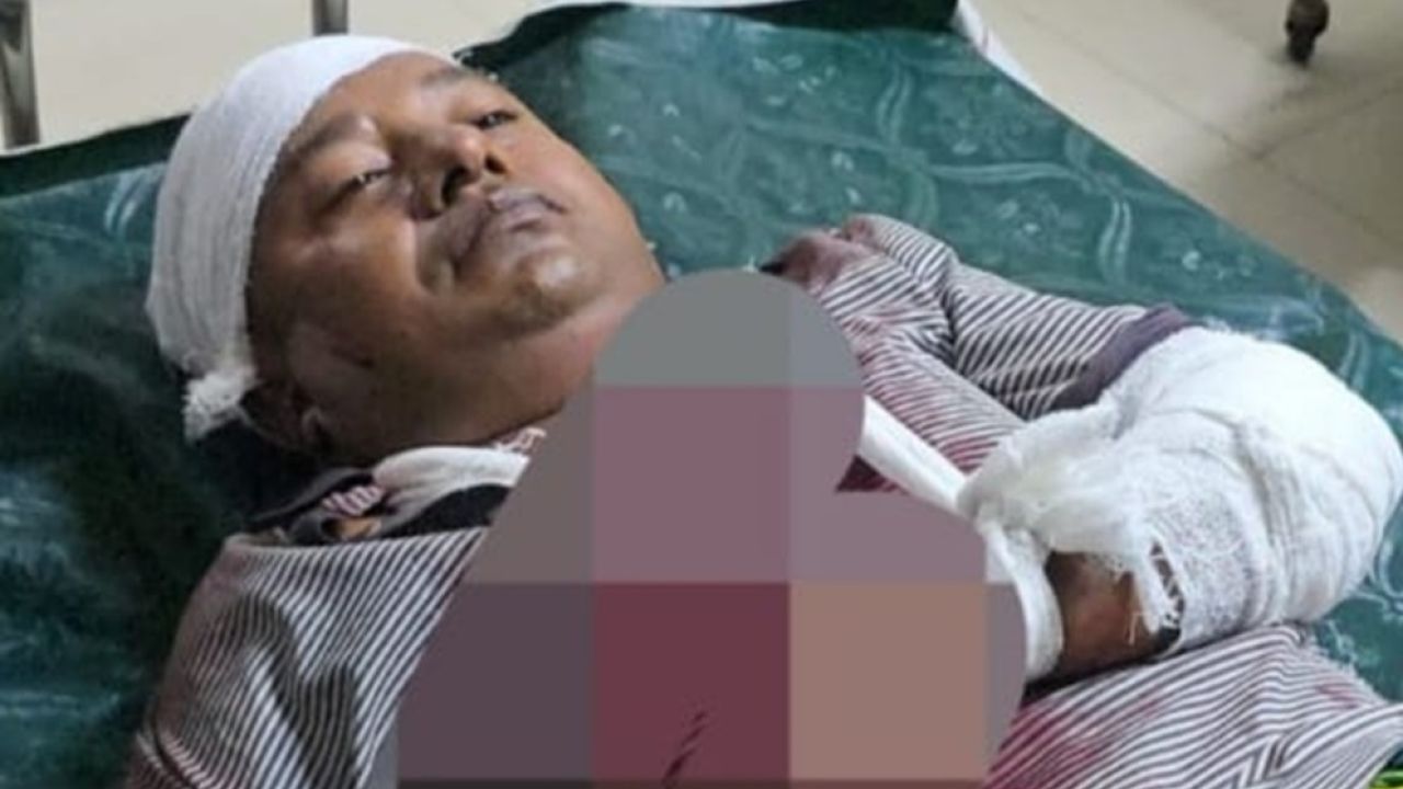 রূপগঞ্জে সালিশ বৈঠকে বিএনপি নেতাকে কুপিয়ে জখম